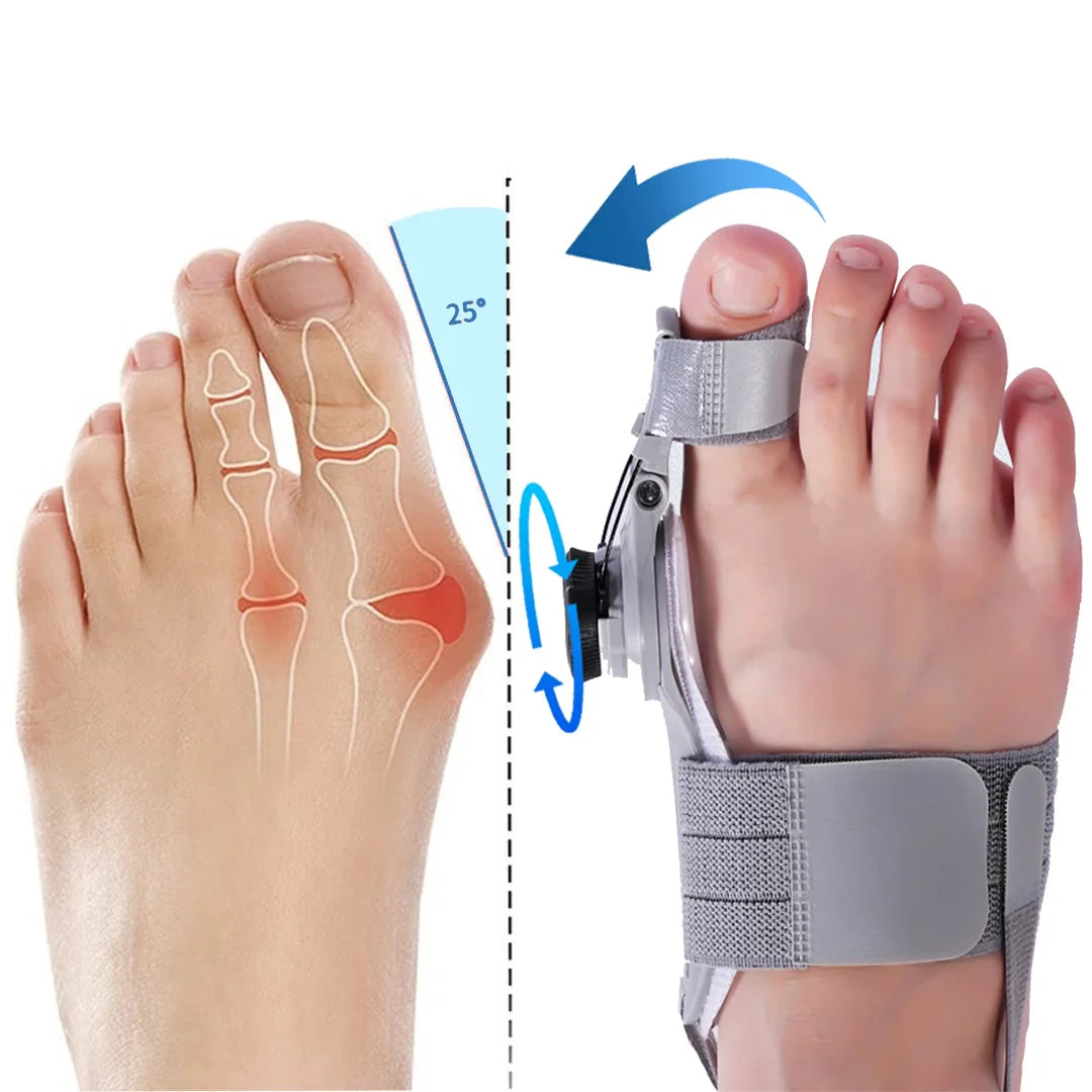 AlignEase Bunion Corrector | Comfort en uitlijning voor gezonde voeten