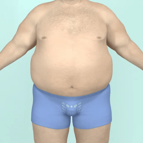 AlphaShape | Bevordert je vetweefselverlies | Voel je snel fit!