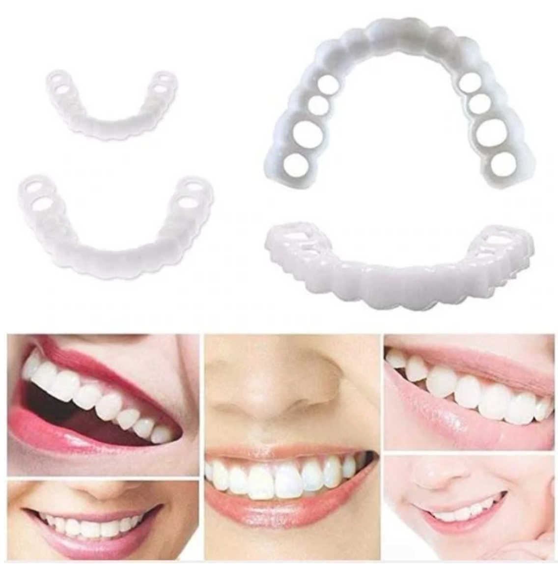 HappySmile Facetset | Herbruikbare boven- en onderfacetten voor een stralende lach