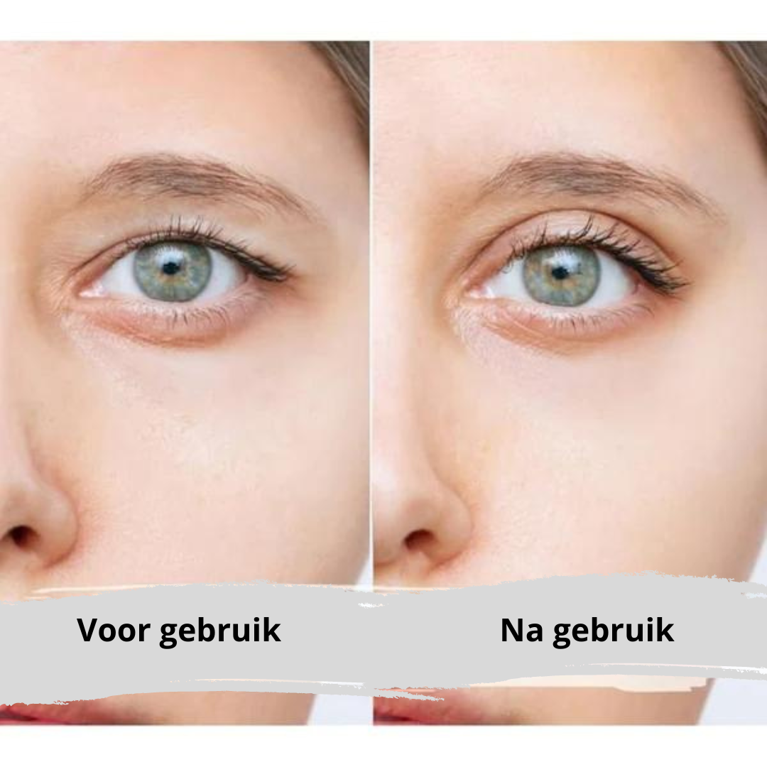 EyePerfection | Dubbele Ooglid Tape tegen hangend ooglid | Unisex