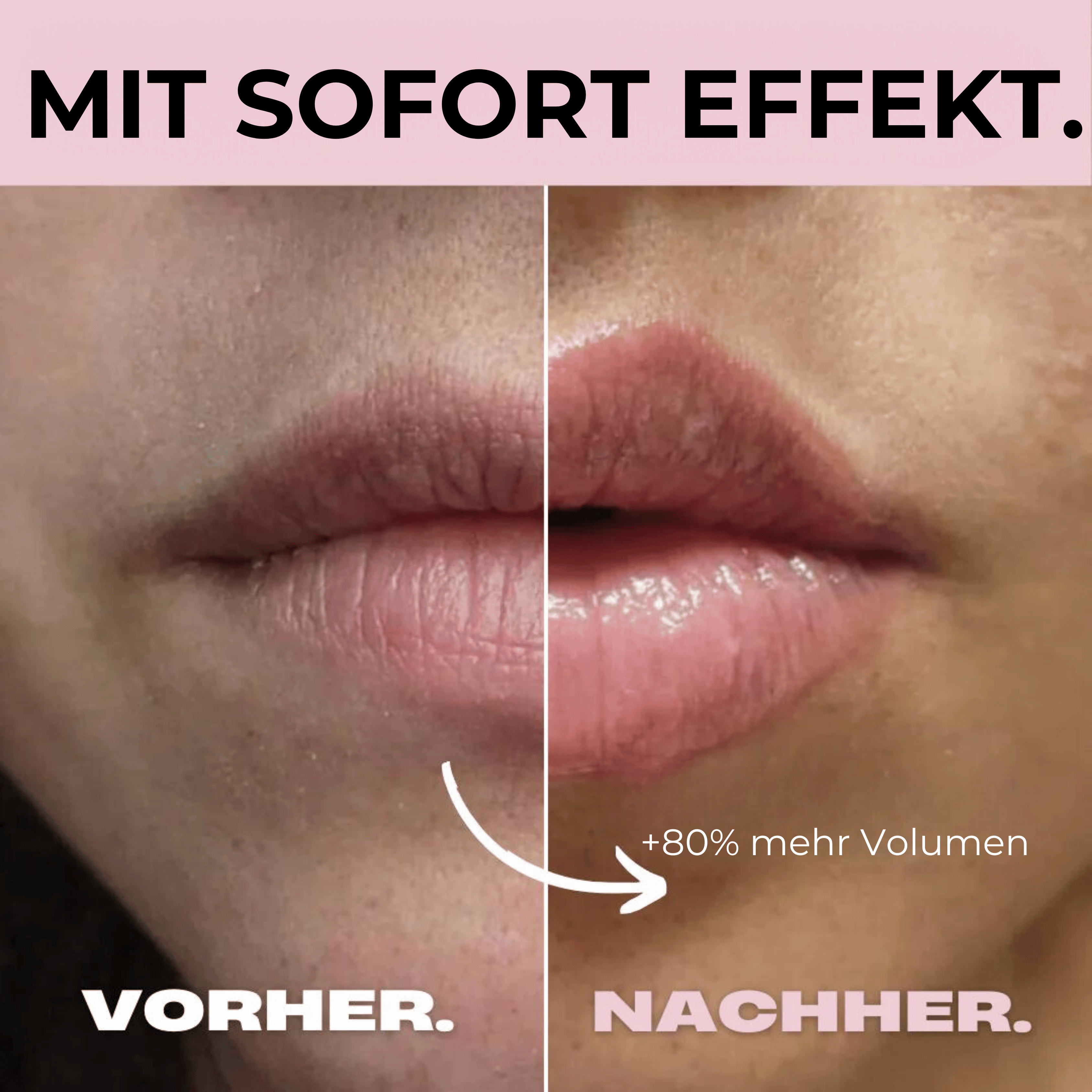 HydraGlow Micro Infusion Roller | hydrateren, voller maken en revitaliseren