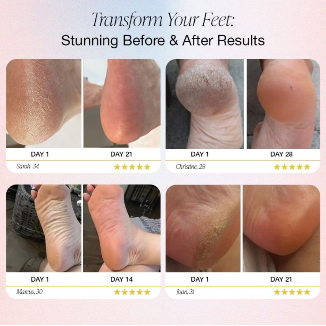 SmootherFeet Elektrisch Pedicure Gereedschap | Professionele verzorging binnen handbereik