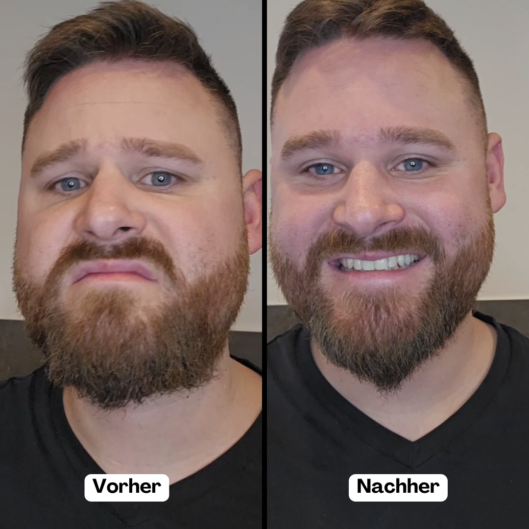 BeardMaster | Draadloze Negatieve Ion Beard Styler