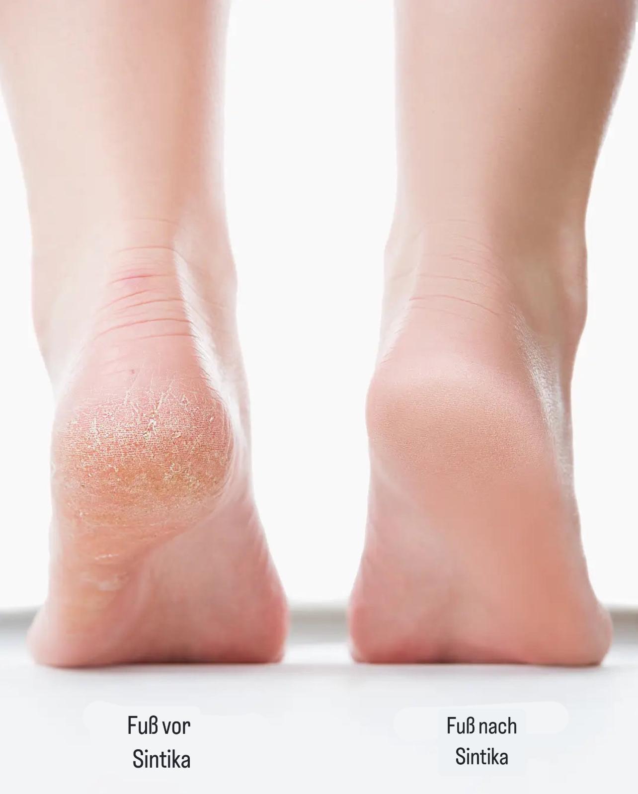 SmoothStep elektrische voetvijl | Moeiteloze verzorging voor mooie voeten