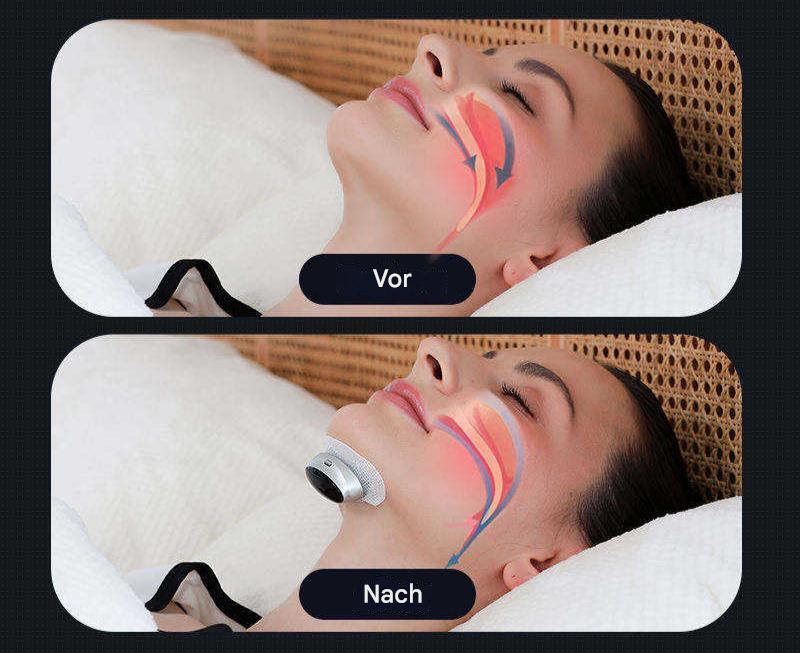 Slaapapneu-hulpmiddel - AirEase