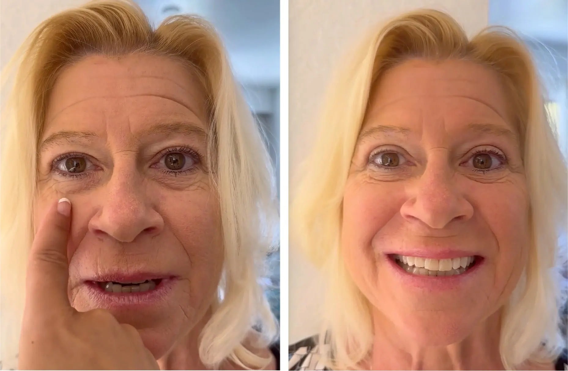 EyePerfection | Dubbele Ooglid Tape tegen hangend ooglid | Unisex