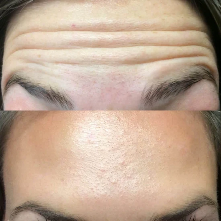 ElysianGlow Luxe Anti-Aging Serum | Voor stralende, jeugdige huid op elke leeftijd