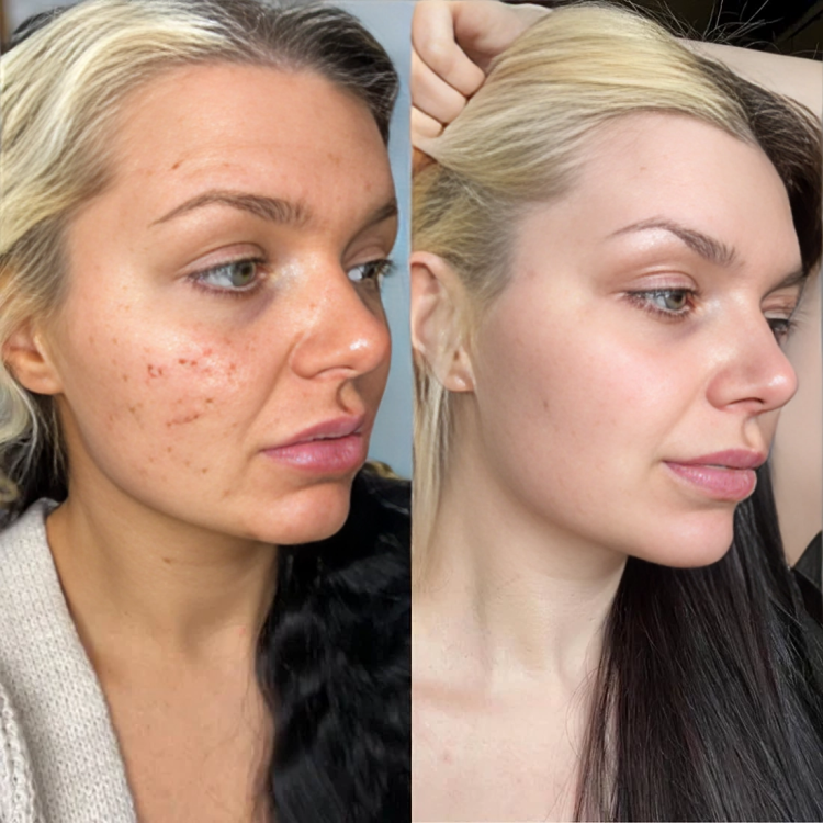 ElysianGlow Luxe Anti-Aging Serum | Voor stralende, jeugdige huid op elke leeftijd