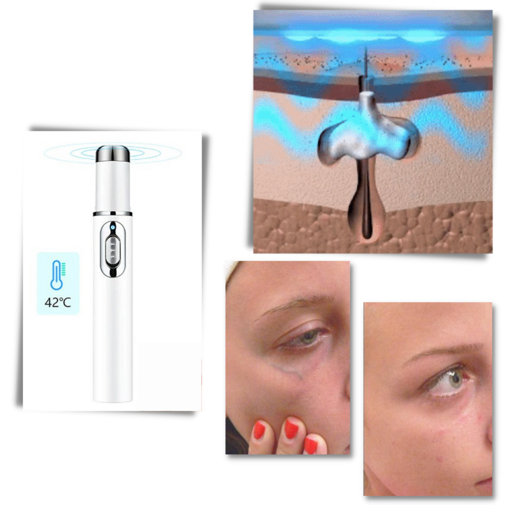 Blauw licht huidtherapie pen