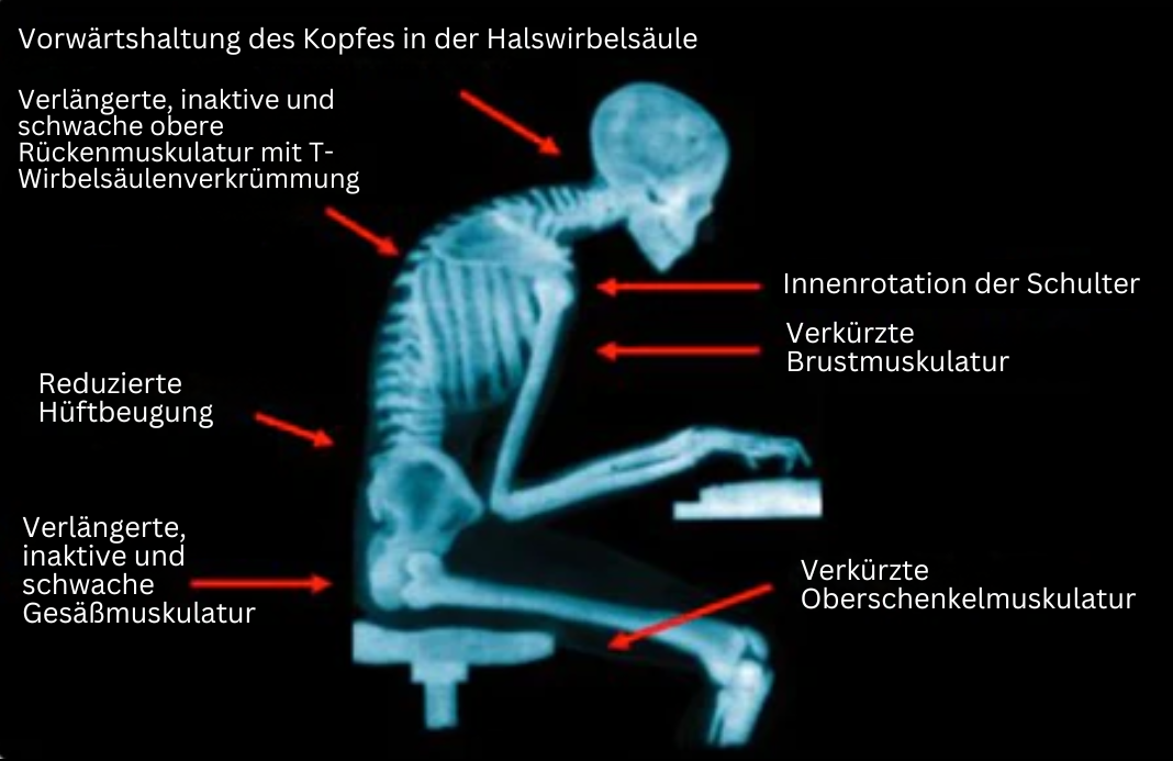 EMS-Houdingsbandage - PosturePro
