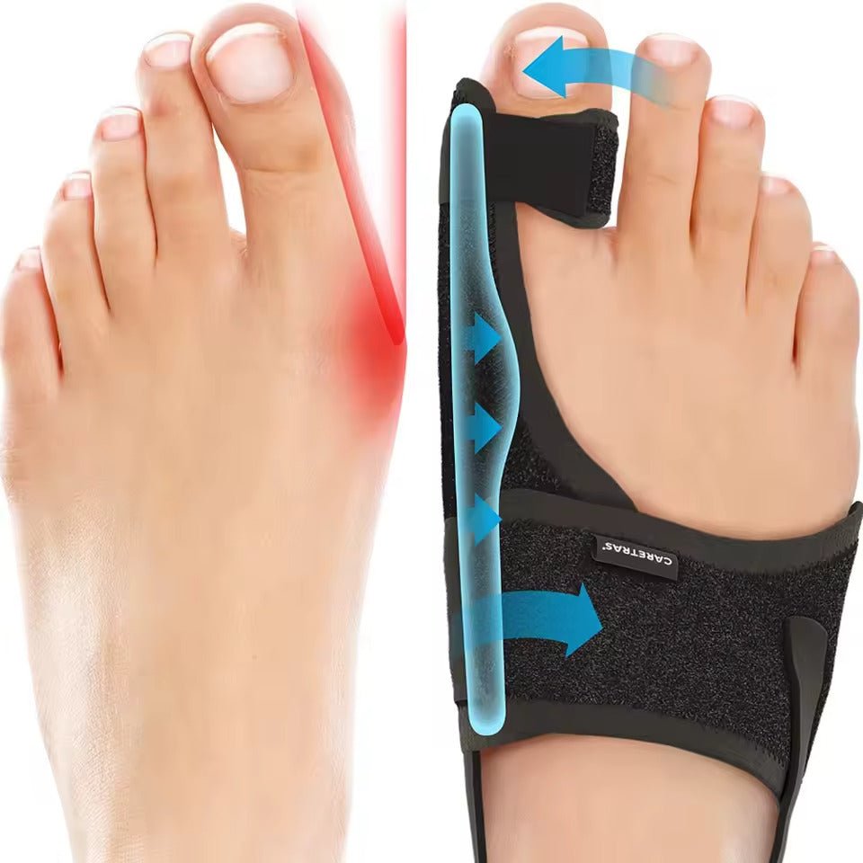 Nachtspalk Hallux Valgus - Ergonomisch en Verstelbaar Comfort