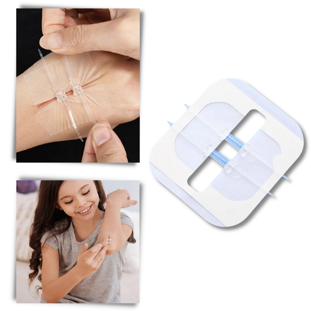 Waterdichte wondhechting