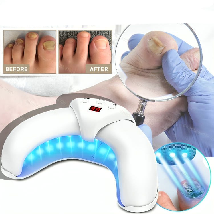 LuxeNail | Antischimmelbehandeling voor nagels – effectief – snel – natuurlijk